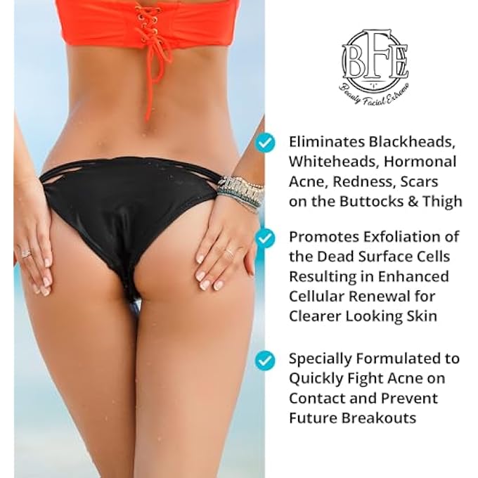 Beauty Facial Extreme ANTI-ACNE BUTTOCKS & THIGH TREATMENT- CLEARS AWAY ACNE, PIMPLES, AND INGROWN HAIRS FOR THE BUTTOCKS AND THIGH AREA. PREVENTS FUTURE BREAKOUTS - Image 2